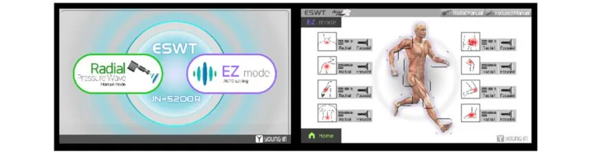 ESWT–Radial Pressure Wave Touch Screen